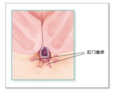 肛门瘙痒原因