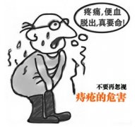 武汉痔疮piles的危害?