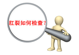 肛裂检查