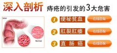 痔疮piles对人体健康的危害都有哪些?