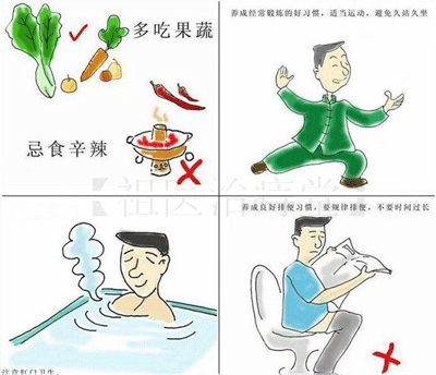 内痔预防